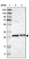 Transmembrane P24 Trafficking Protein 1 antibody, PA5-53826, Invitrogen Antibodies, Western Blot image 