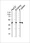 Acyl-CoA Dehydrogenase Long Chain antibody, LS-C160991, Lifespan Biosciences, Western Blot image 