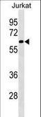 Pre-mRNA-splicing factor SLU7 antibody, LS-C159038, Lifespan Biosciences, Western Blot image 