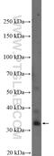 Prostate Transmembrane Protein, Androgen Induced 1 antibody, 16521-1-AP, Proteintech Group, Western Blot image 