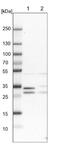 Dimethylarginine Dimethylaminohydrolase 2 antibody, NBP1-86092, Novus Biologicals, Western Blot image 