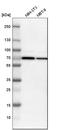 SMAD Family Member 4 antibody, HPA019154, Atlas Antibodies, Western Blot image 