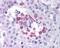 MAGE-3 antigen antibody, 49-713, ProSci, Immunohistochemistry frozen image 