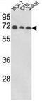 Abl Interactor 1 antibody, GTX81190, GeneTex, Western Blot image 