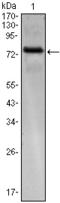 Kelch Like Family Member 25 antibody, M14745, Boster Biological Technology, Western Blot image 