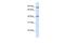 Thioredoxin-related transmembrane protein 4 antibody, GTX46032, GeneTex, Western Blot image 