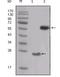 SRC Proto-Oncogene, Non-Receptor Tyrosine Kinase antibody, NBP1-47524, Novus Biologicals, Western Blot image 