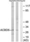 Acyl-CoA Binding Domain Containing 6 antibody, TA315909, Origene, Western Blot image 