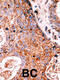 Lemur Tyrosine Kinase 2 antibody, 62-681, ProSci, Immunohistochemistry paraffin image 