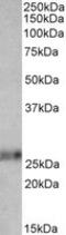 Ephrin A1 antibody, MBS422490, MyBioSource, Western Blot image 