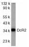 TNF Receptor Superfamily Member 10d antibody, SP1174P, Origene, Western Blot image 
