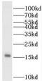 P53 And DNA Damage Regulated 1 antibody, FNab06289, FineTest, Western Blot image 