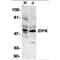 Death Associated Protein Kinase 3 antibody, MBS150711, MyBioSource, Western Blot image 