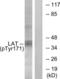 Linker For Activation Of T Cells antibody, LS-C199189, Lifespan Biosciences, Western Blot image 