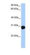 SLAM family member 6 antibody, NBP1-62353, Novus Biologicals, Western Blot image 