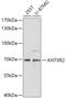ANTXR Cell Adhesion Molecule 2 antibody, 22-287, ProSci, Western Blot image 