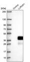 Leucine Rich Adaptor Protein 1 antibody, PA5-56329, Invitrogen Antibodies, Western Blot image 