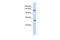 Roundabout Guidance Receptor 2 antibody, PA5-42723, Invitrogen Antibodies, Western Blot image 