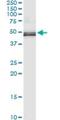 Tu Translation Elongation Factor, Mitochondrial antibody, H00007284-M03, Novus Biologicals, Immunoprecipitation image 