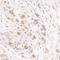 Replication Timing Regulatory Factor 1 antibody, A300-569A, Bethyl Labs, Immunohistochemistry frozen image 