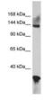 GLI Family Zinc Finger 2 antibody, PA1-30042, Invitrogen Antibodies, Western Blot image 