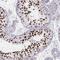 Histone Cluster 1 H1 Family Member T antibody, HPA068266, Atlas Antibodies, Immunohistochemistry paraffin image 