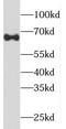 Phosphatidylinositol Glycan Anchor Biosynthesis Class T antibody, FNab06446, FineTest, Western Blot image 