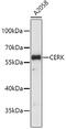 Ceramide Kinase antibody, 19-500, ProSci, Western Blot image 