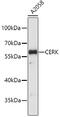 Ceramide kinase antibody, 19-500, ProSci, Western Blot image 