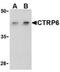 C1q And TNF Related 6 antibody, NBP1-77218, Novus Biologicals, Western Blot image 