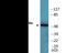 Nuclear receptor subfamily 2 group A member 1 antibody, EKC2431, Boster Biological Technology, Western Blot image 