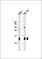 PHD finger-like domain-containing protein 5A antibody, GTX03384, GeneTex, Western Blot image 