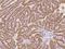 Interleukin 5 Receptor Subunit Alpha antibody, 310251-T08, Sino Biological, Immunohistochemistry frozen image 