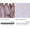 Cadherin 1 antibody, NBP2-34476, Novus Biologicals, Immunohistochemistry paraffin image 