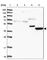 Fumarylacetoacetate Hydrolase antibody, HPA044093, Atlas Antibodies, Western Blot image 