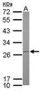 ATP Synthase Peripheral Stalk-Membrane Subunit B antibody, GTX102980, GeneTex, Western Blot image 