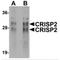 Cysteine Rich Secretory Protein 2 antibody, MBS150306, MyBioSource, Western Blot image 