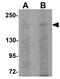 Signal Induced Proliferation Associated 1 Like 1 antibody, GTX85228, GeneTex, Western Blot image 