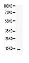 IL-4 antibody, LS-C313461, Lifespan Biosciences, Western Blot image 