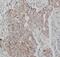 Hedgehog Interacting Protein antibody, FNab03854, FineTest, Immunohistochemistry paraffin image 