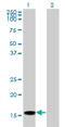 Acid Phosphatase antibody, LS-B14477, Lifespan Biosciences, Western Blot image 