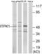 Inositol-Tetrakisphosphate 1-Kinase antibody, LS-B9944, Lifespan Biosciences, Western Blot image 