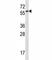 FYN Proto-Oncogene, Src Family Tyrosine Kinase antibody, F44219-0.4ML, NSJ Bioreagents, Western Blot image 