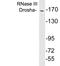 Ribonuclease 3 antibody, A19835, Boster Biological Technology, Western Blot image 