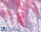 Keratin 20 antibody, LS-B4527, Lifespan Biosciences, Immunohistochemistry paraffin image 