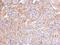 PPFIA Binding Protein 2 antibody, GTX112301, GeneTex, Immunohistochemistry paraffin image 