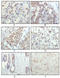 Ribosomal Protein S6 Kinase A1 antibody, M01058, Boster Biological Technology, Immunohistochemistry paraffin image 