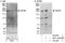 Transient Receptor Potential Cation Channel Subfamily M Member 7 antibody, NBP1-46829, Novus Biologicals, Immunoprecipitation image 