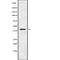 C-C Motif Chemokine Receptor 8 antibody, abx149028, Abbexa, Western Blot image 