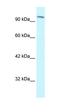 SWI/SNF Related, Matrix Associated, Actin Dependent Regulator Of Chromatin Subfamily C Member 1 antibody, orb329715, Biorbyt, Western Blot image 